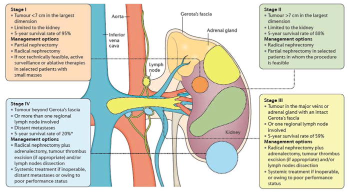 【佳学基因检测】肾脏癌靶向药物基因检测（Kidney Cancer)