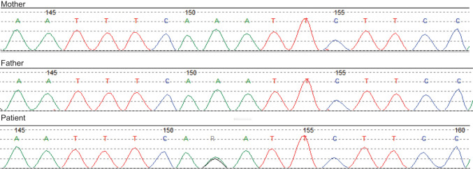 【佳学基因检测】做后颌过小、微小后颌基因解码、基因检测的费用是多少？