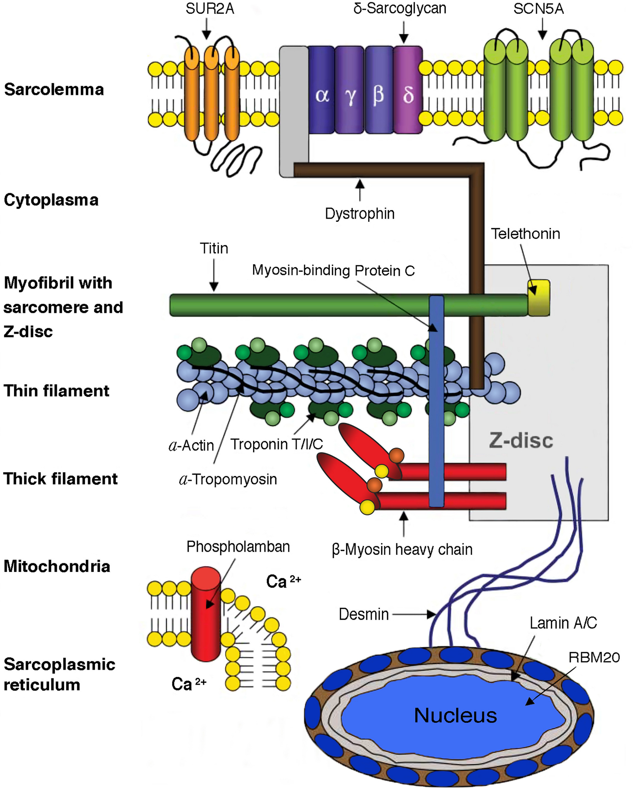 【佳学基因检测】一图展示全面性扩张型心肌病基因检测的位点及遗传方式