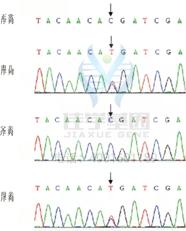 【基因检测基因解码案例】巴特综合症——佳学基因