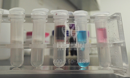 【佳学基因解码-基因检测】为什么到医院检查抽血需要空腹？喝水算不算空腹？看完你就明白了！